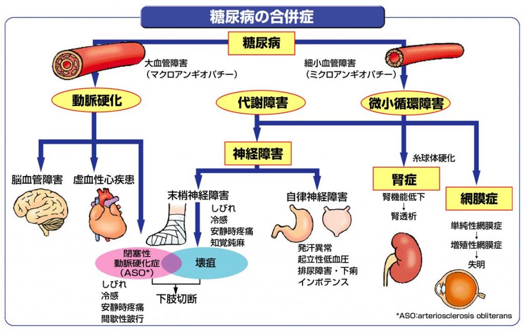 糖尿病の合併症 さくら内科クリニック